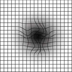 Macular Degeneration – Terrace Eye Centre